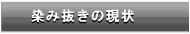 しみ抜きの現状